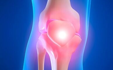 Die Gründe für die Entwicklung der Arthrose des Kniegelenks