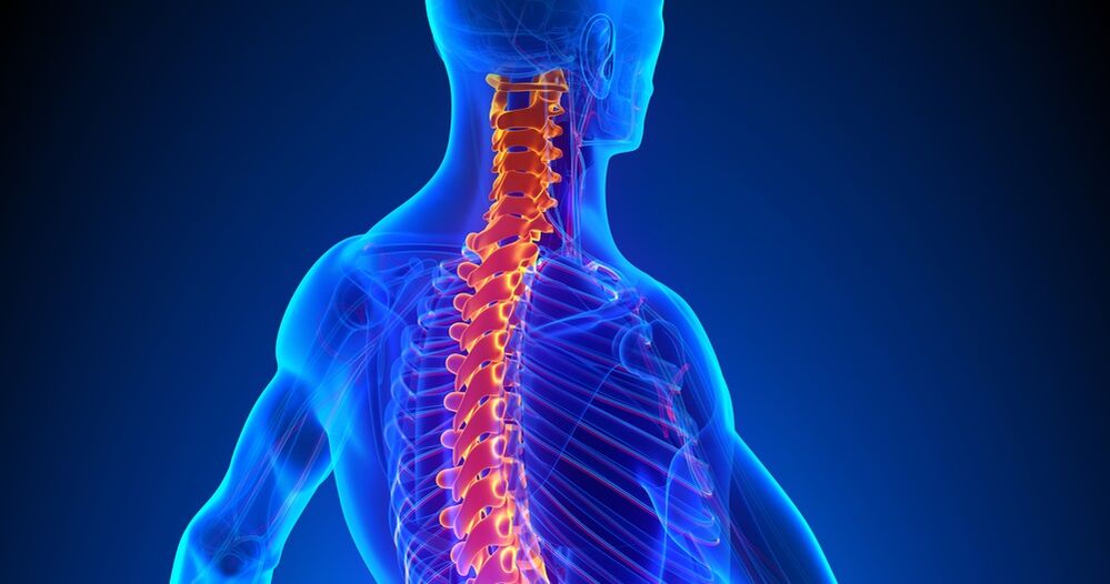 Osteochondritis der Wirbelsäule