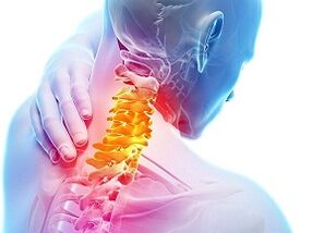 Ursachen für zervikale Osteochondrose